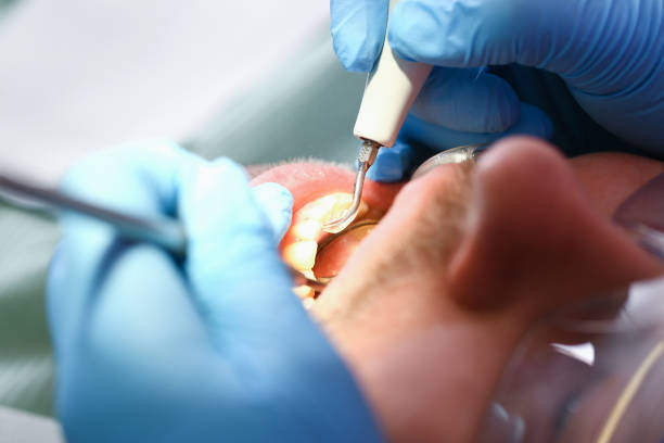 Best Urgent Care for Lost Fillings or Crowns in Hammond, LA
