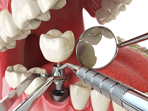 Best Emergency Dental Care for Broken or Chipped Teeth in Hammond, LA